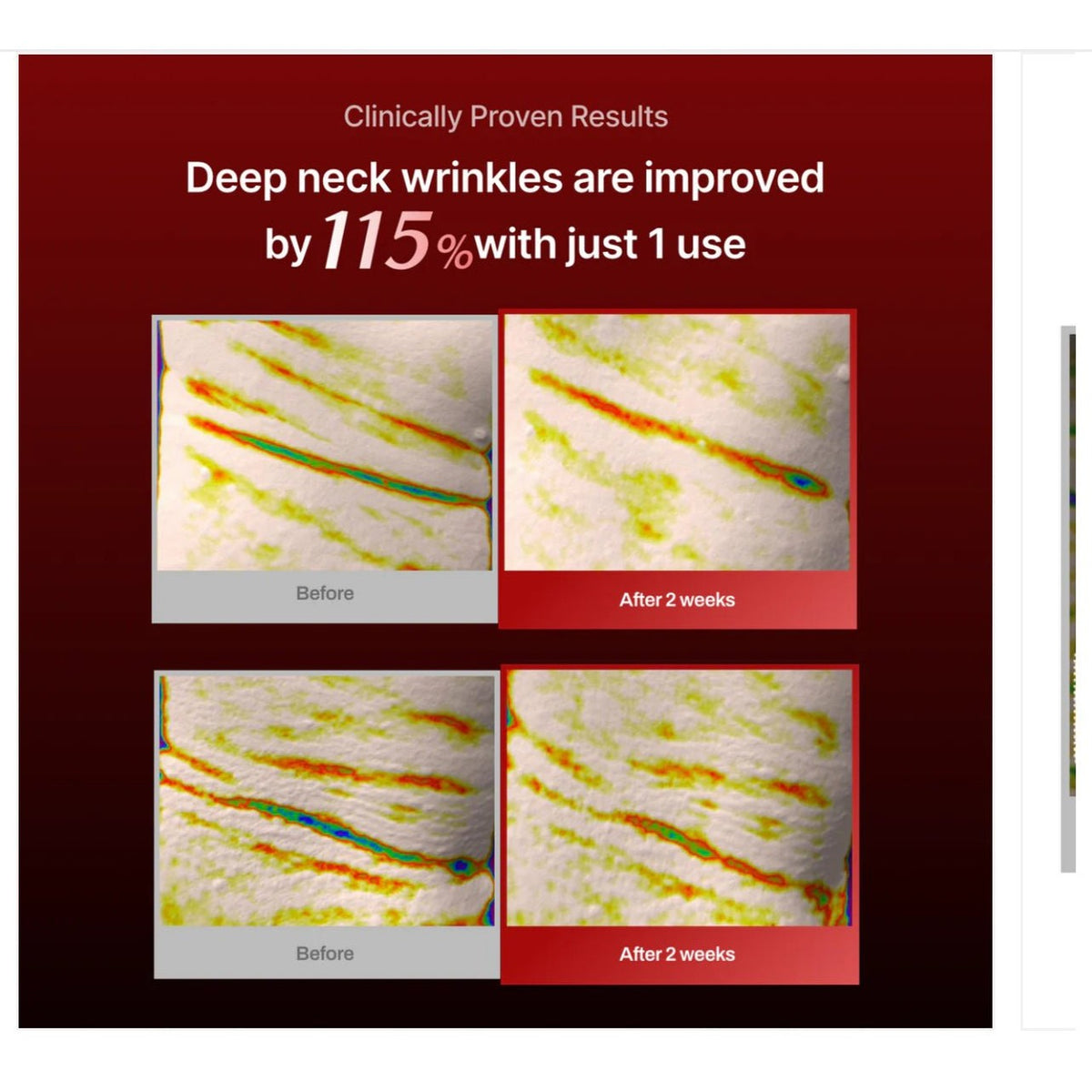 Meditherapy Wrinkle Neck mask