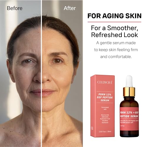 Salmon DNA PDRN 120,000 ppm EGF Peptide Microneedling Serum w/Volufiline, Phyto PDRN 12%, Growth Factor - Anti-Aging Face Serum with Niacinamide, Hyaluronic Acid 1 Fl Oz Korean Skincare - Medaid International