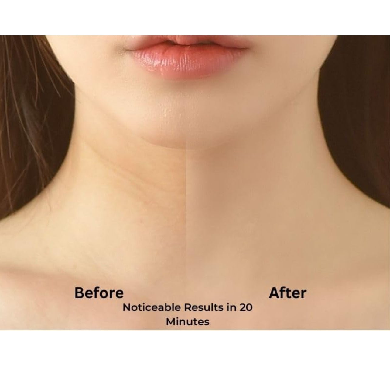 Neck LIFTING MASK