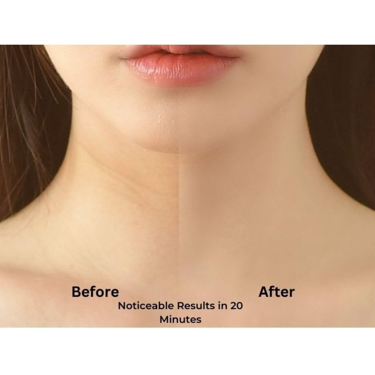 Neck LIFTING MASK
