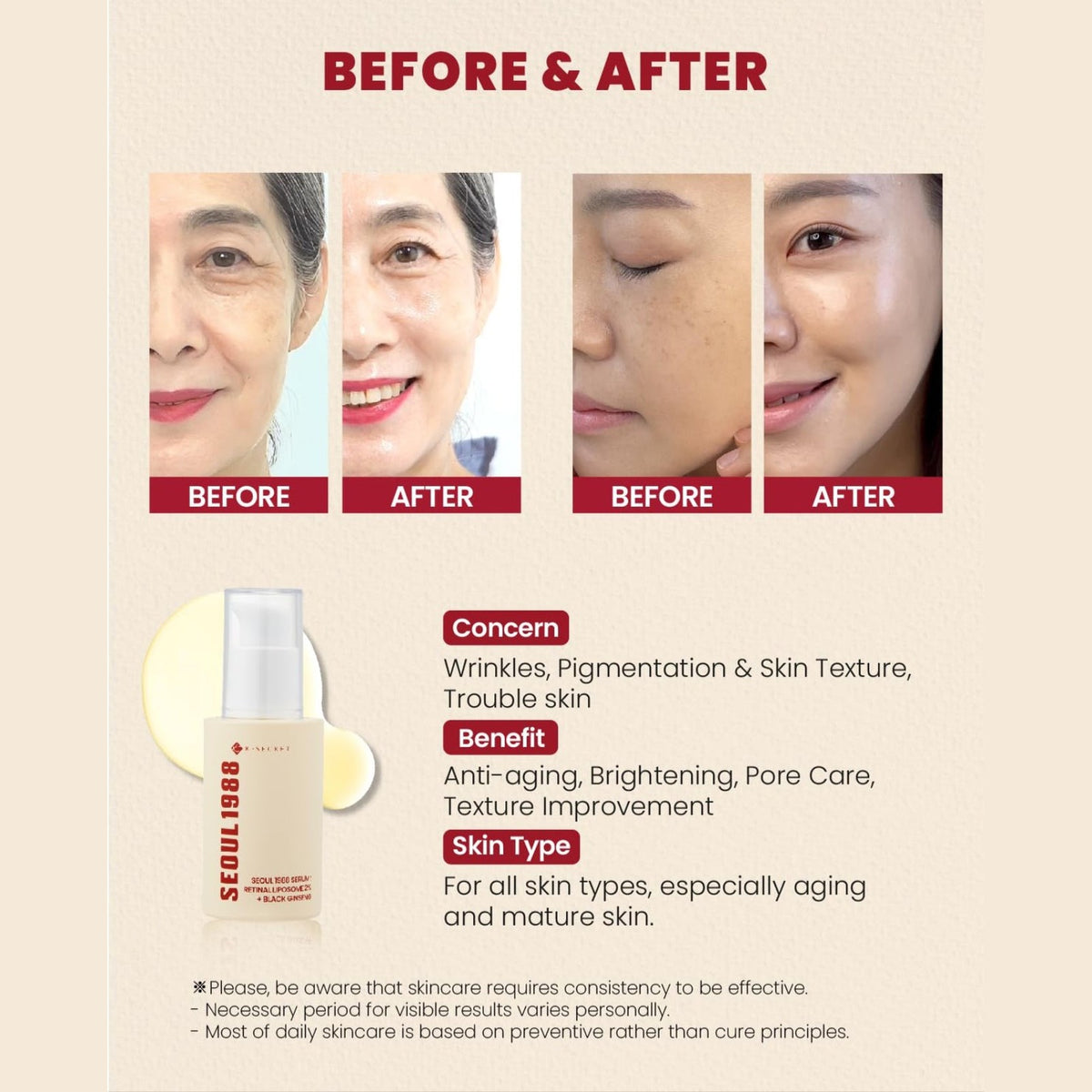 SEOUL 1988 SERUM:
RETINAL LIPOSOME 1%
+ fermented rice
