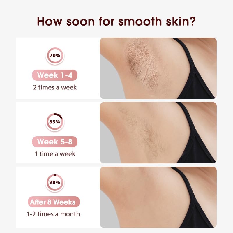 Laser Hair Removal with Cooling, at-Home IPL Hair Removal for Women Men, Upgraded to 999,900 Flashes Permanent Hair Removal Device on Facial Legs Arms Bikini Line - Medaid International