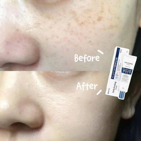 Melatoning cream 30g