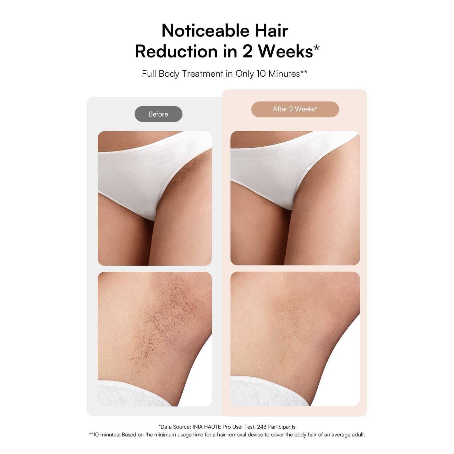 INIA Laser Hair Removal with Ice-Cooling Care for Women and Men, HAUTE Pro Painless at-Home IPL Hair Remover for Coarse Hair in Bikini All Body Areas, Latest Generation for Effective Results (Pink) - Medaid International