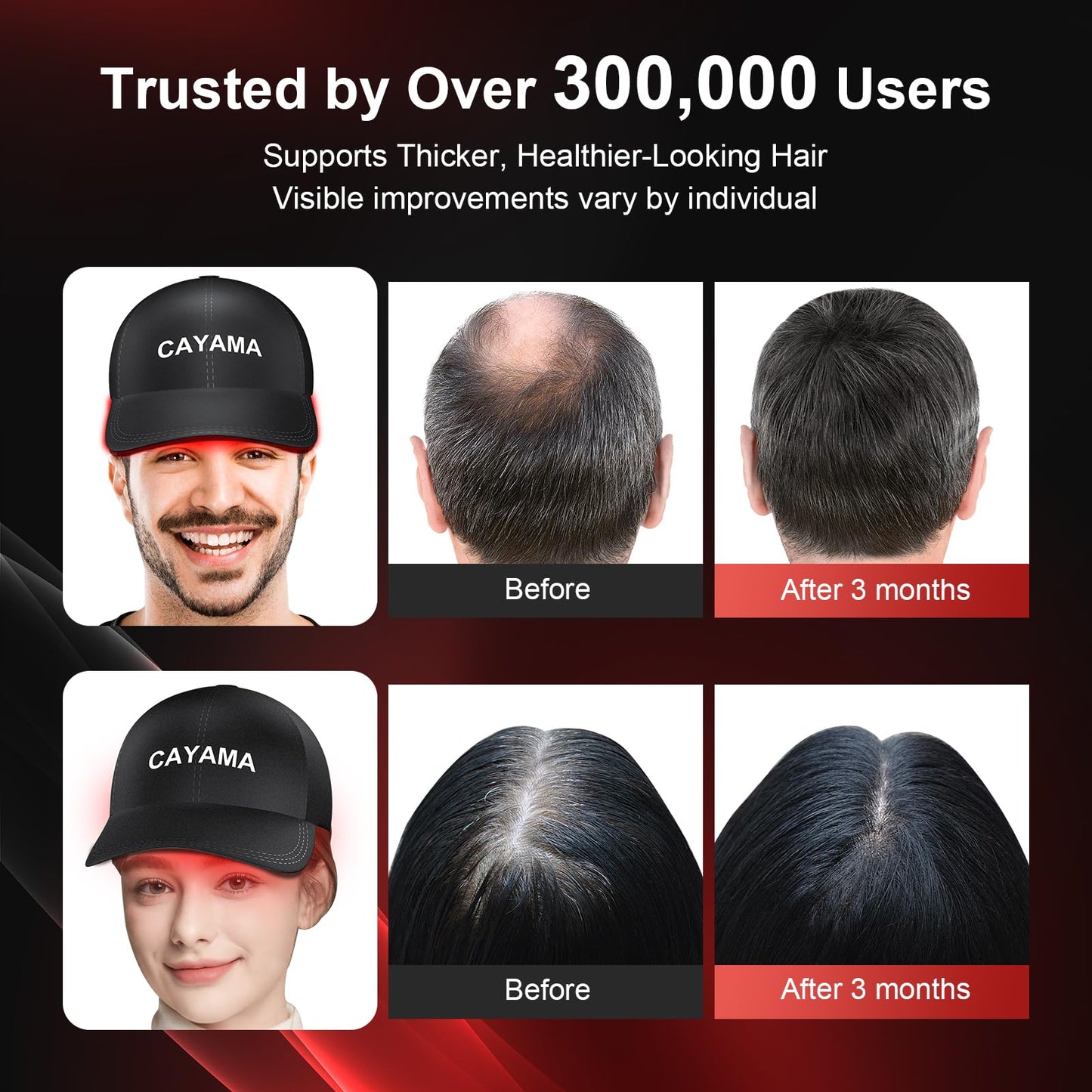 CAYAMA Red Light Therapy Cap for Hair β 510 LED Laser Hair Cap for Fuller, Healthier-Looking Hair, Rechargeable Light-Based Care Device for Men & Women - Medaid International