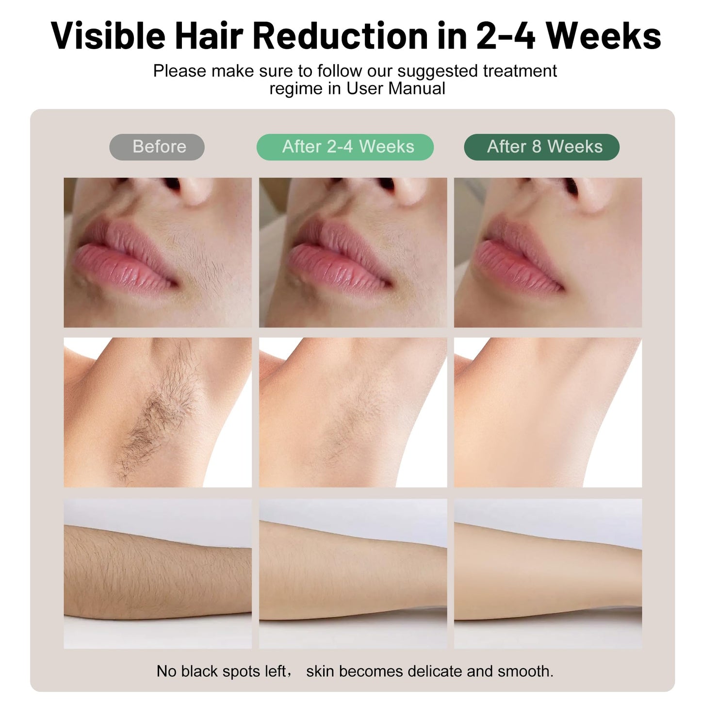 Myelecsio Laser Hair Removal, IPL Hair Removal Device with Cooling Function, Safe, Long-lasting and Virtually Painless Treatment, Unlimited Flashes at Home Use - Medaid International