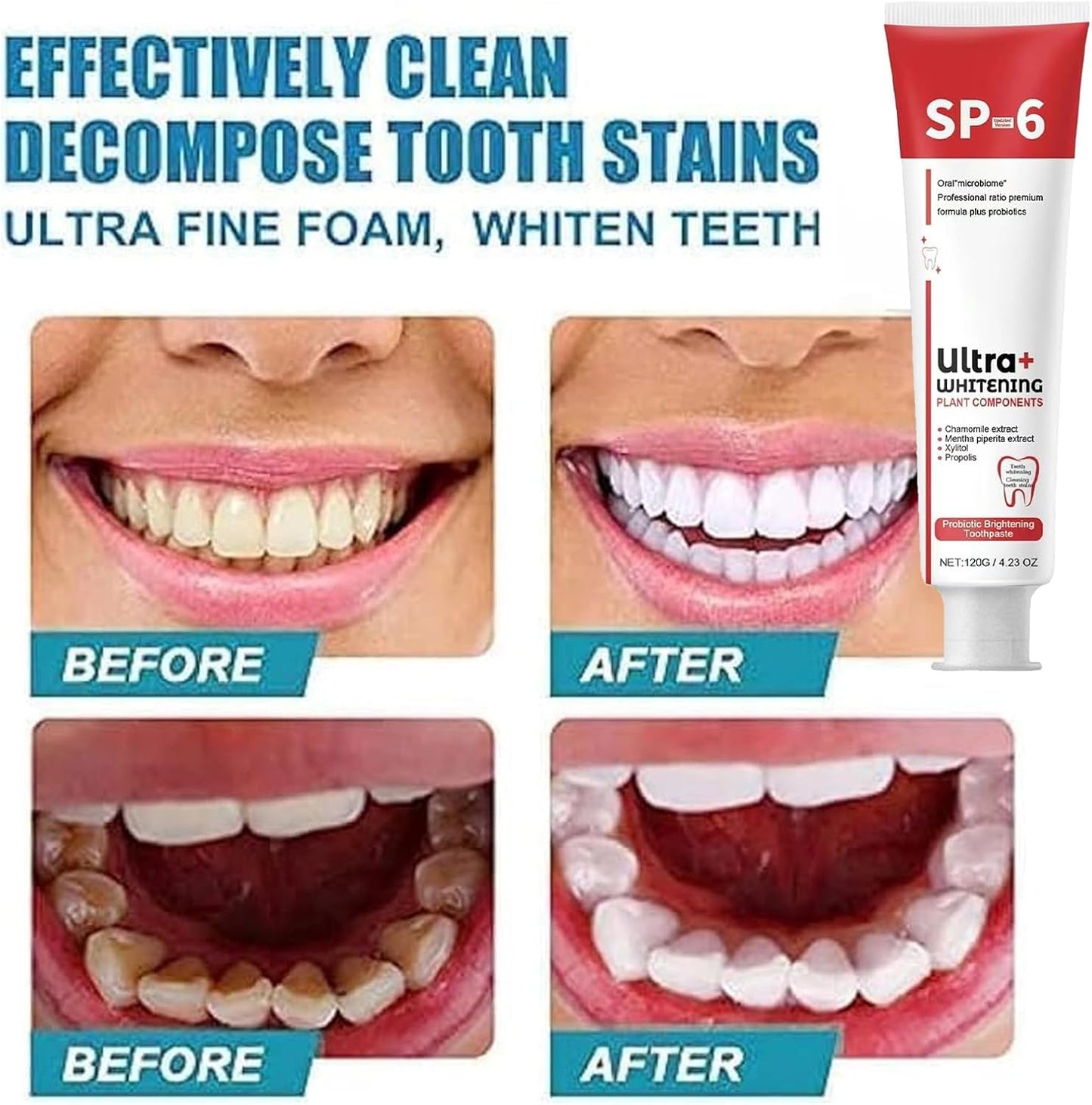 SP-6 Toothpaste Ultra Whitening معجون أسنان SP-6 فائق التبييض