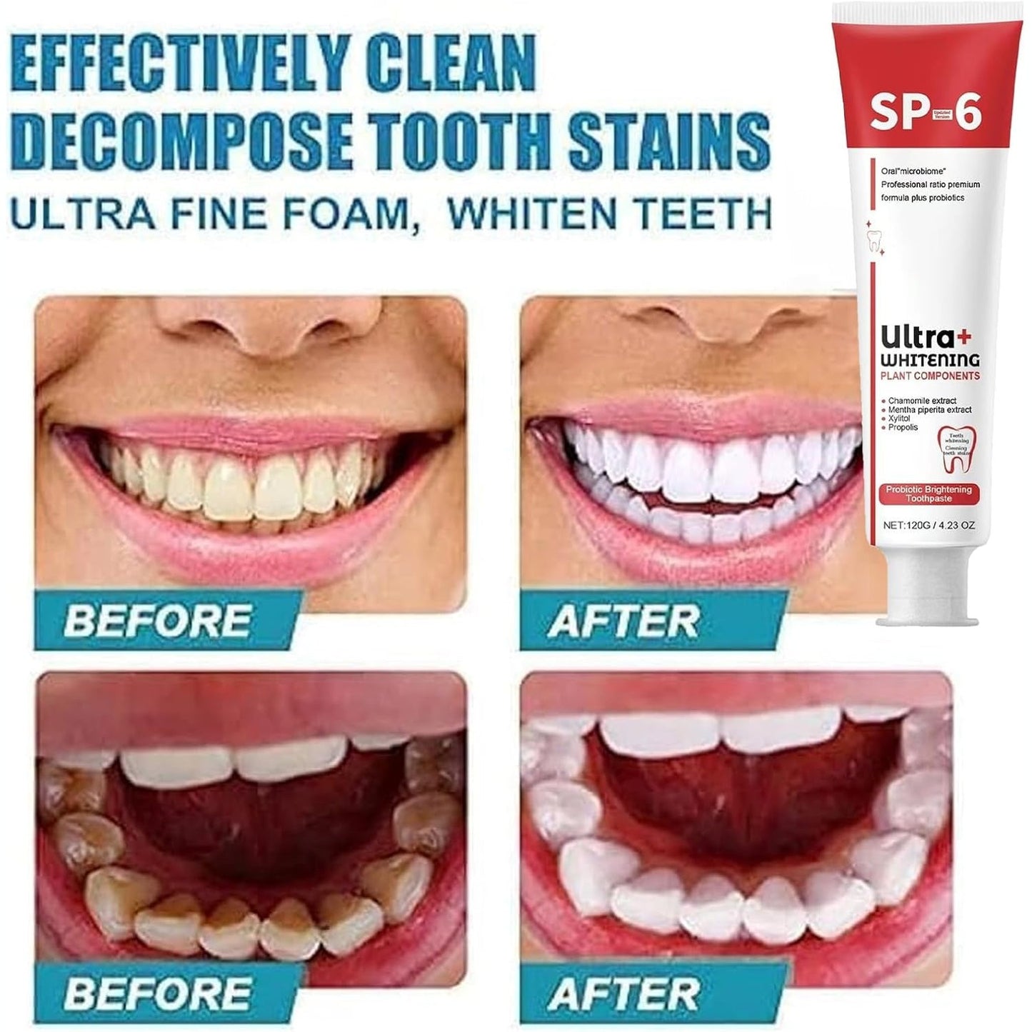 SP-6 Toothpaste Ultra Whitening معجون أسنان SP-6 فائق التبييض
