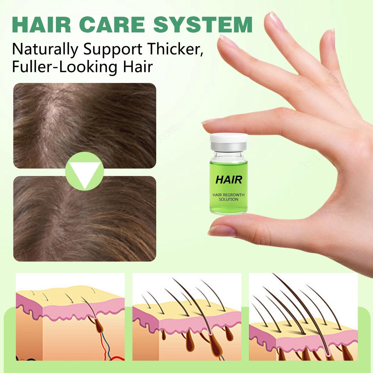 Hair Regrowth System, Advanced Hair Growth Treatment Ginseng, Eclipta Prostrata,Peppermint Oil & Ginger Root,Strengthens Hair Roots,Thickening Serum for Men & Women (1 Set) - Medaid International