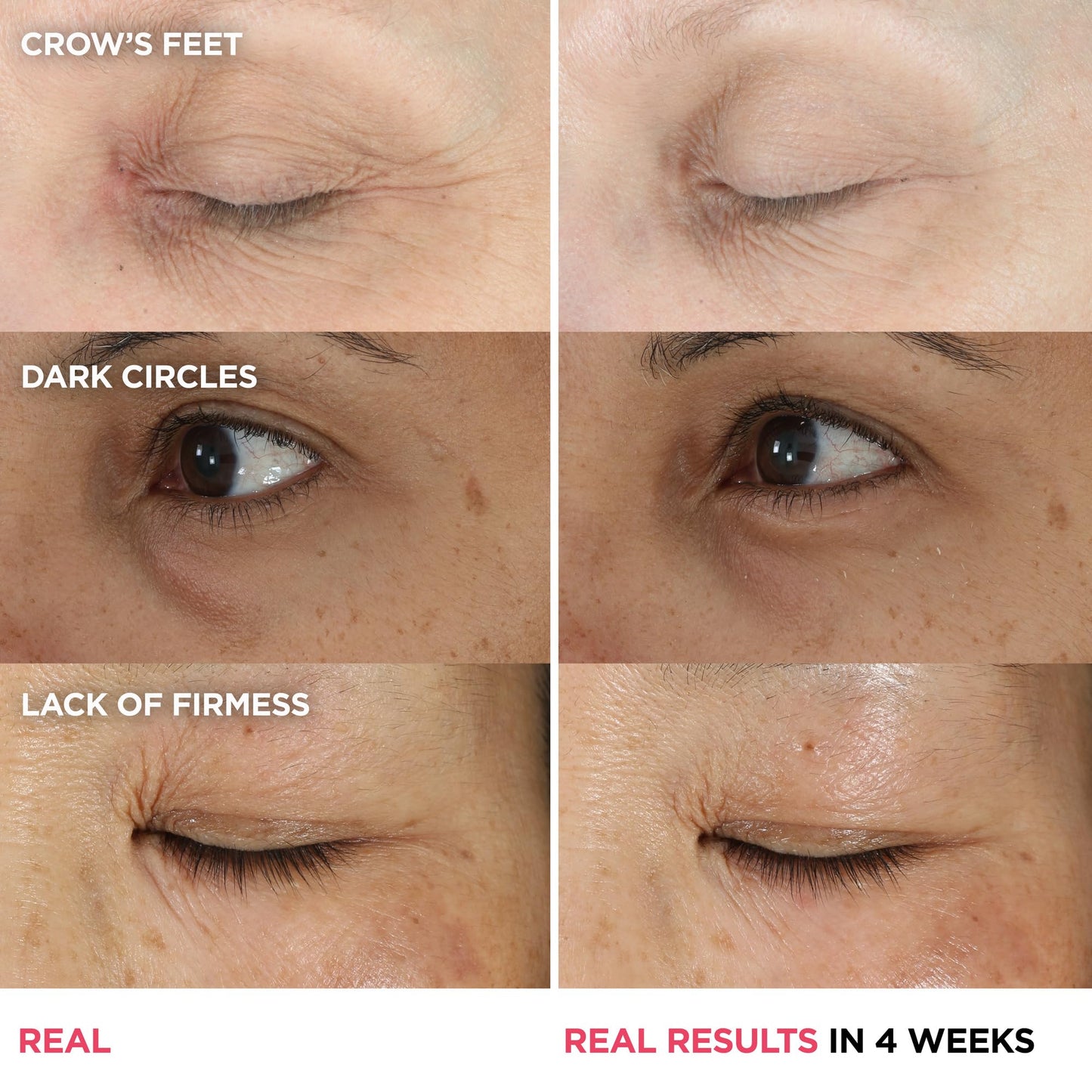 IT Cosmetics Confidence in an Eye Cream - Anti Aging Peptide Eye Cream for Dark Circles & Wrinkles, Lightweight 48HR Hydration, 2% Super Peptide Concentrate, Smooth & Brighten Undereye - 0.5 fl oz - Medaid International