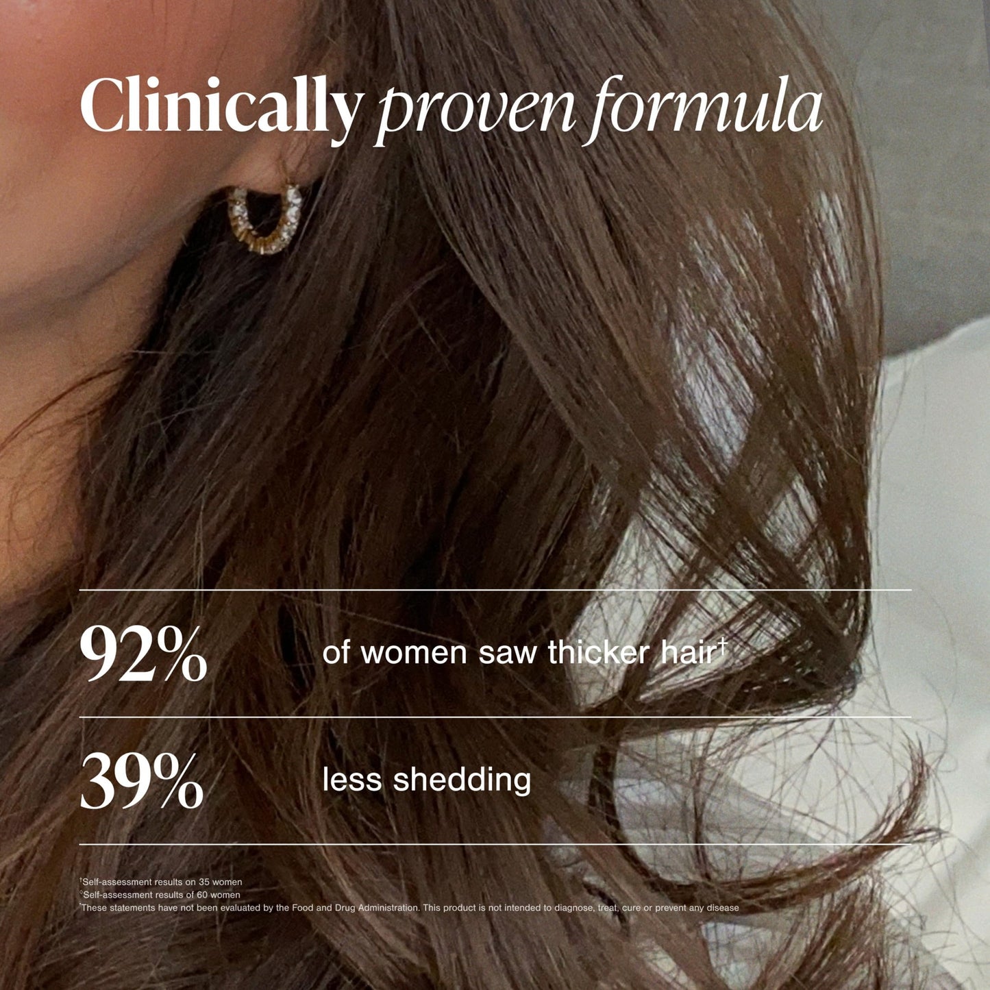Viviscal Hair Growth Supplements for Women, Thicker Fuller Hair Support for Thinning Hair and Hair Loss, with Biotin and Marine Collagen, Drug-Free, 180 Tablets, 90-Day Supply - Medaid International