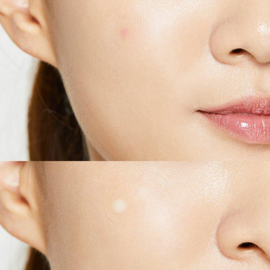 Cosrx Acne Pimple Master Patch