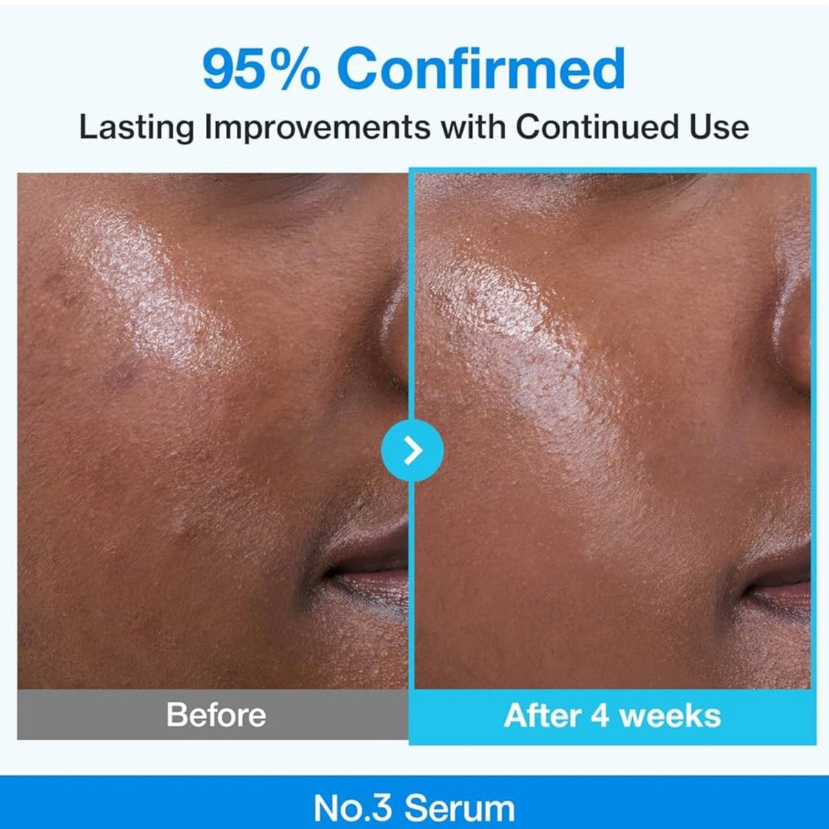 Numbuzin 3+ Blue Bio-Retinol Pore Refining Serum 30ml