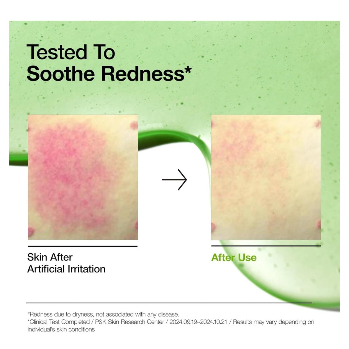 ANUA
AZELAIC HYALURON SOOTHING SERUM 30ML