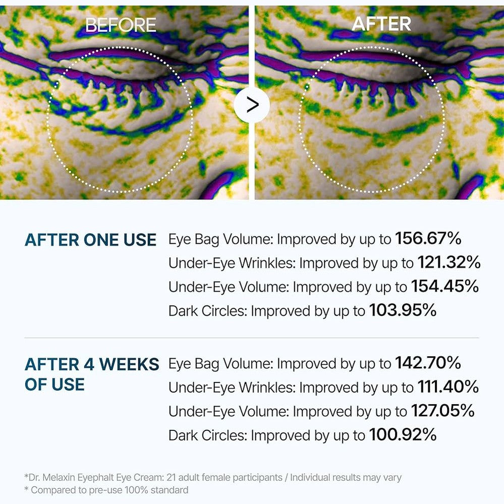 Dr. Melaxin Eyephalt Eyebag Cream 10ml