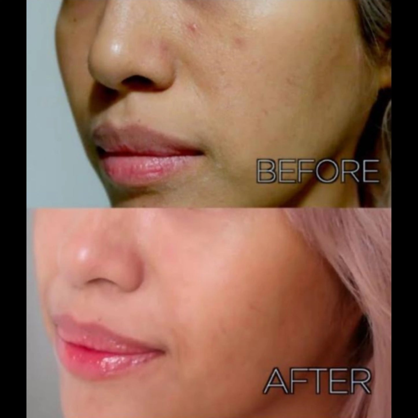 1004 Madagascar Centella Hyalu-Cica Blue serum 5 Hyaluronic Acid