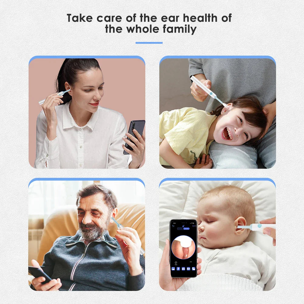 Intelligent Ear Wax Cleaner with 500MP Camera منظف أذن ذكي بكاميرا 500 ميغابكسل