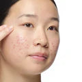 The Ordinary Aloe 2% + NAG 2% Solution For Post-Acne Marks 30ml