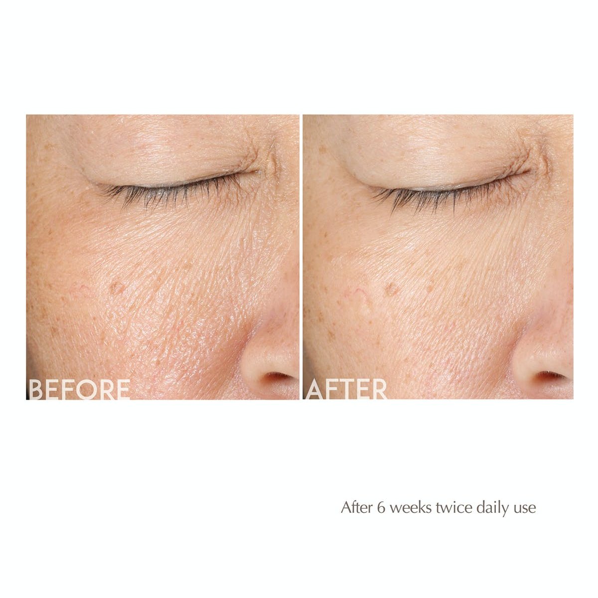 Obagi-C Rx Exfoliating Day Lotion