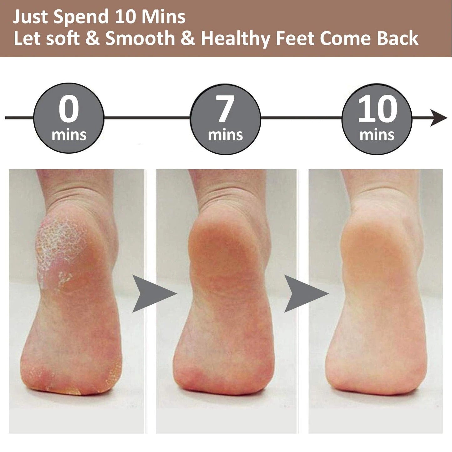 REWELL Rechargeable Electric Foot File Callus Remover