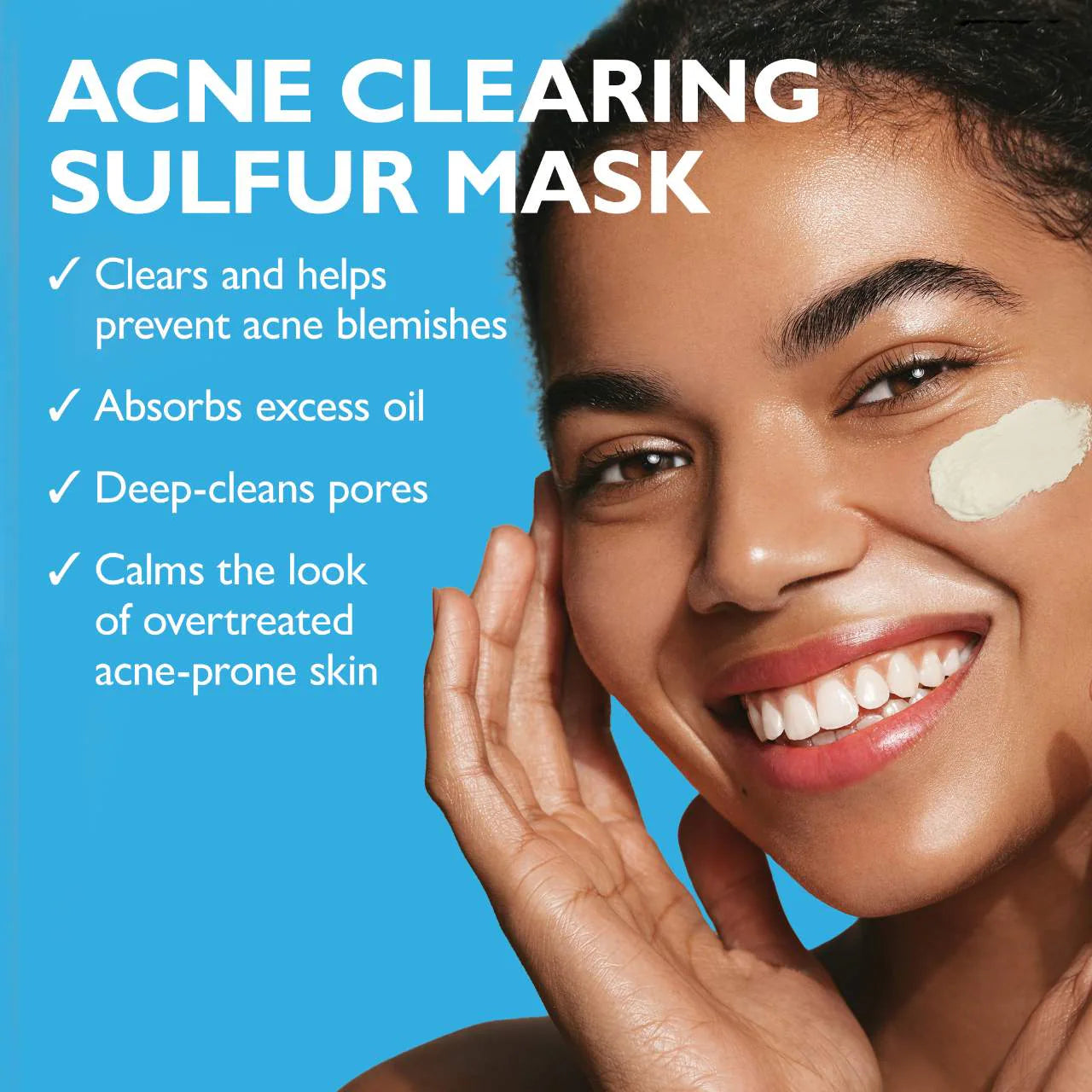 Peter Thomas Roth - Goodbye Acne™ Therapeutic Sulfur Mask | 150 mL - Medaid International