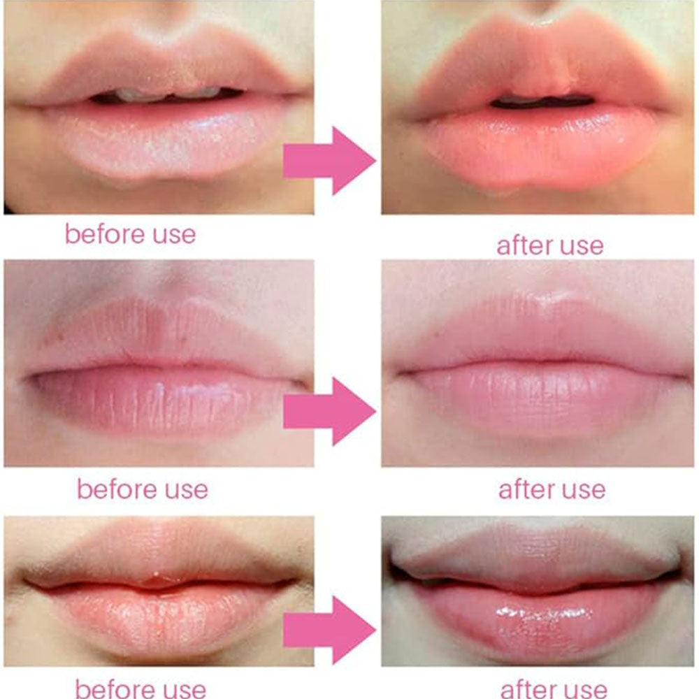 (NET) Eelhoe Cherry Lip Mask 5 Pack Collagen Crystal Gel Lip Care Masks