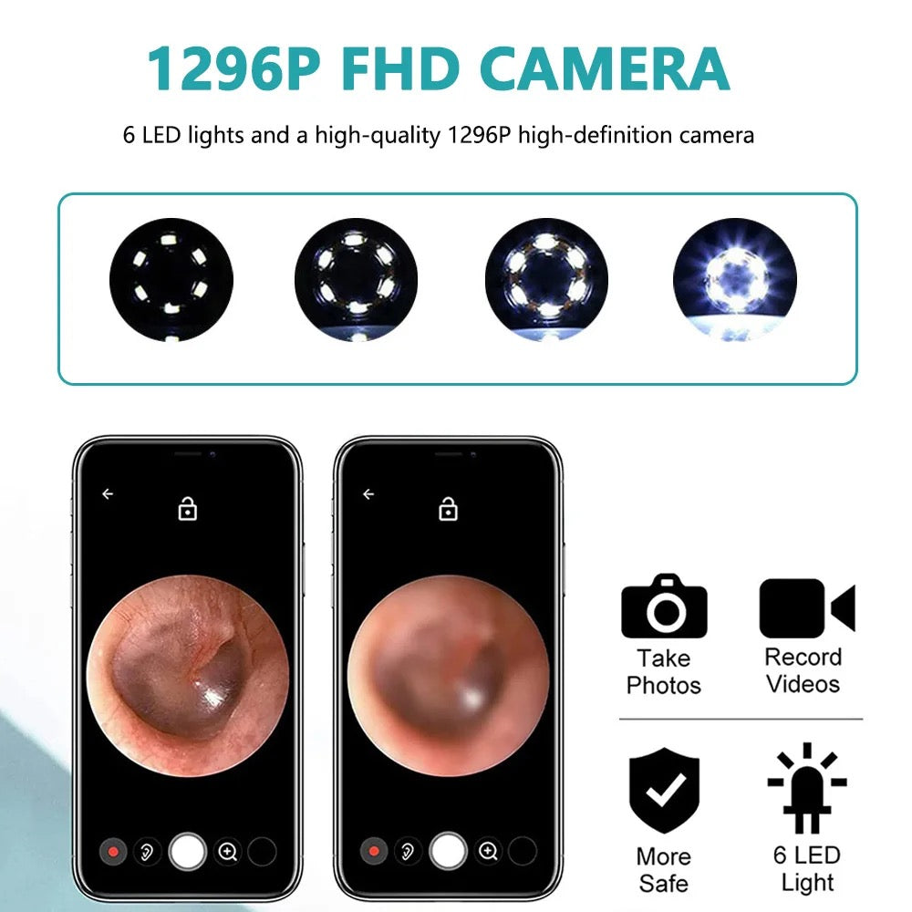 Intelligent Ear Wax Cleaner with 500MP Camera منظف أذن ذكي بكاميرا 500 ميغابكسل