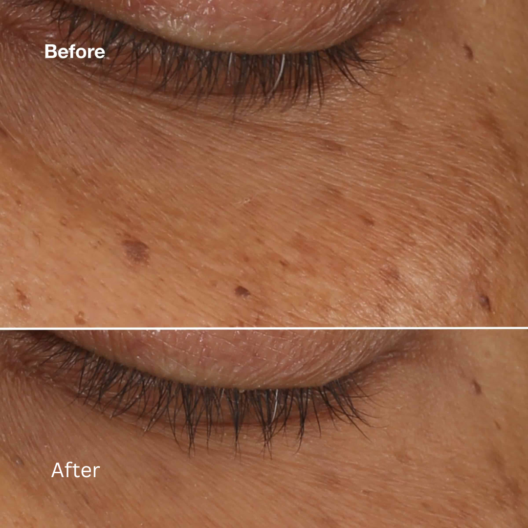 Clinique All About Eyes Brightening Serum Concentrate 10ml