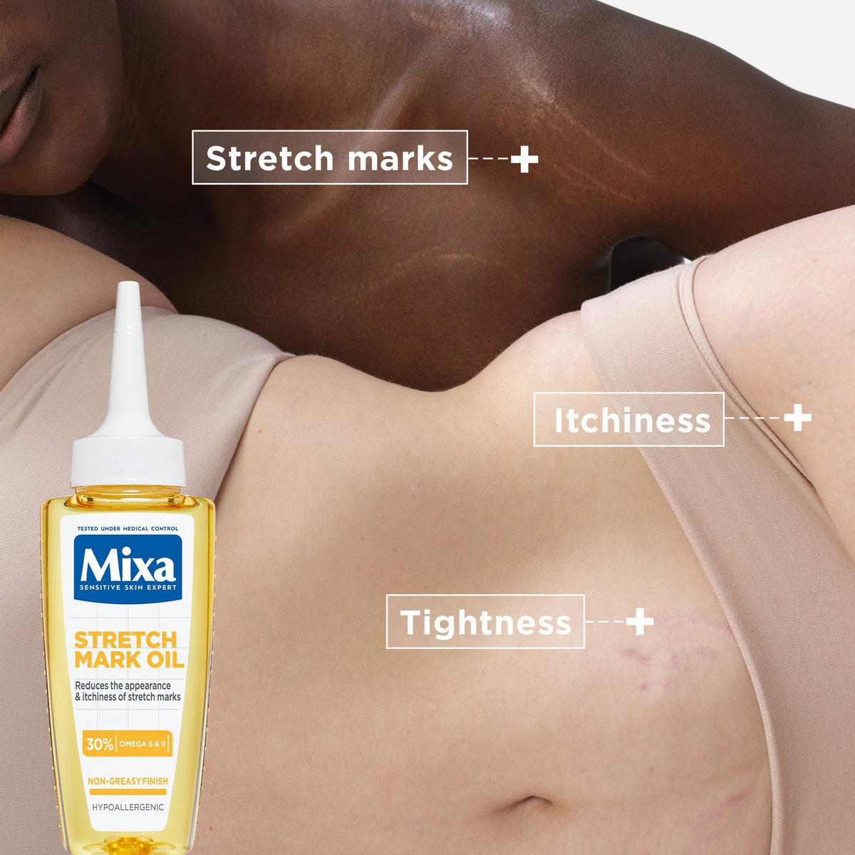 Mixa Anti Stretch Mark Oil - For Skin with Stretch Marks - With Omega 6 & 9 - 100 ml