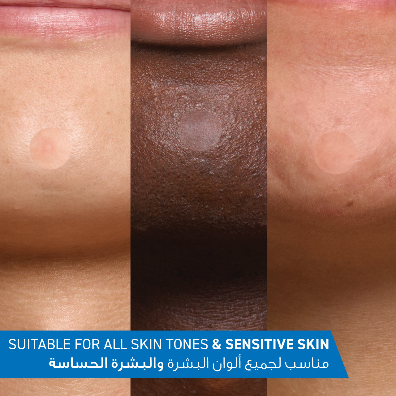 Blemish Barrier Patches With 3 Essential Ceramides and Niacinamide, 22pcs