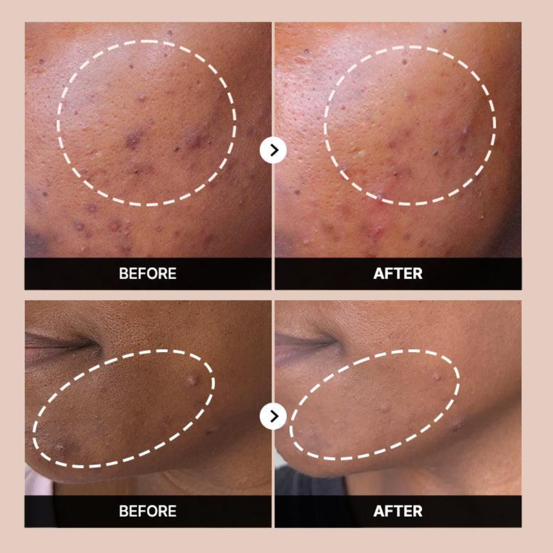 Cosrx The Alpha-Arbutin 2 Discoloration Care Serum 50ml