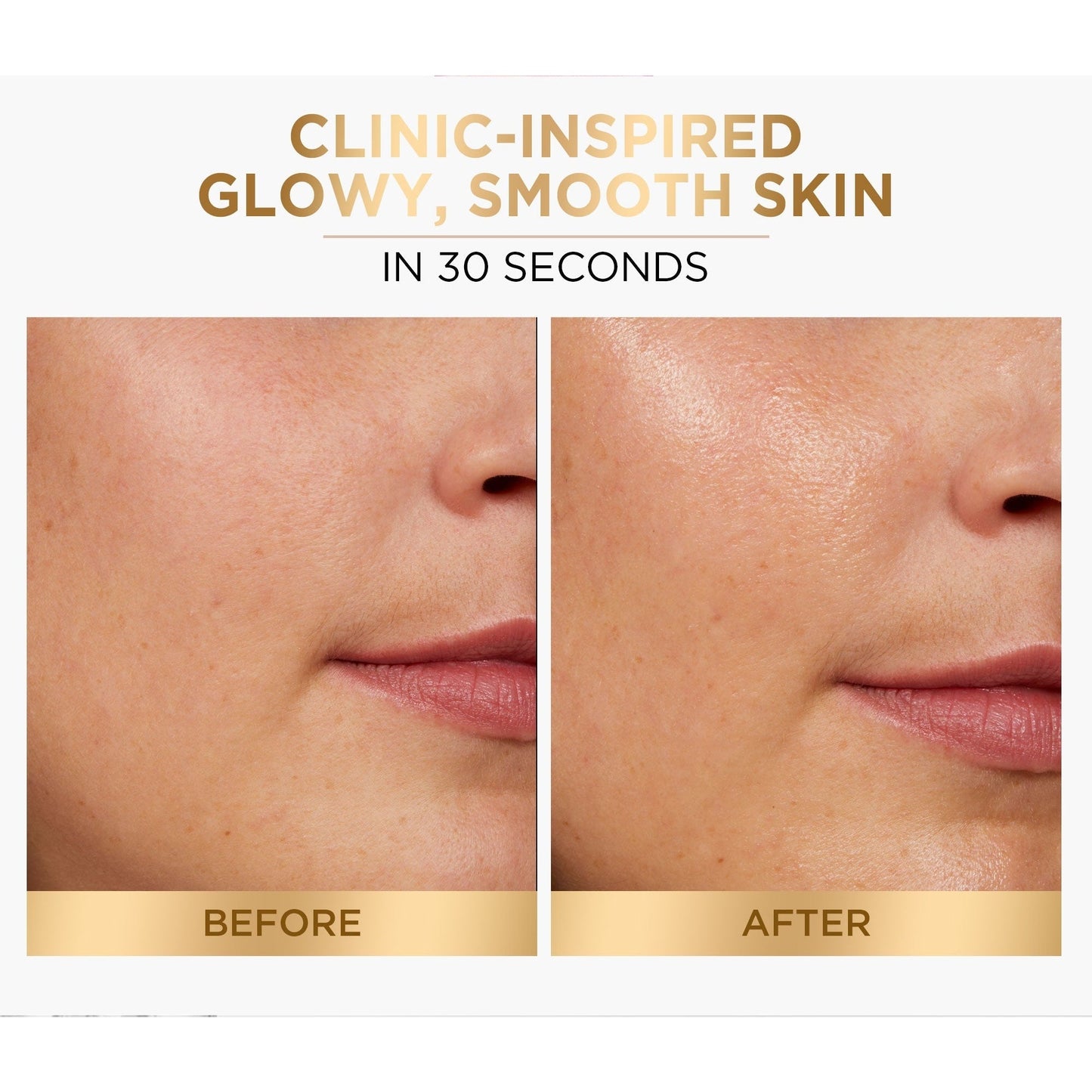 L’Oréal Paris 5% Glycolic Acid Peeling Toner For Instant Glowing Skin - Medaid