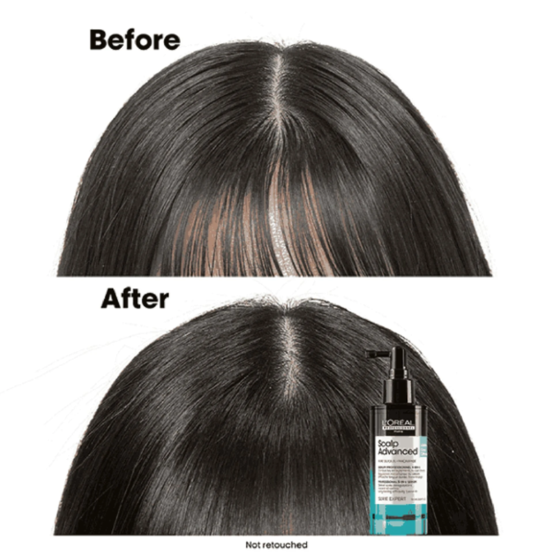 L'Oréal Professionnel Scalp Advanced Serie Expert Anti-Oiliness Serum 90ml