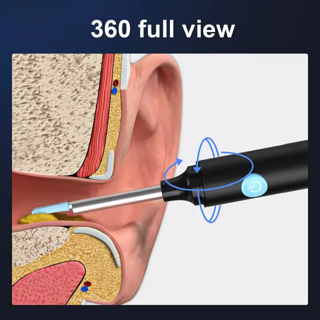 White Ear Wax Removal Tool with Camera – HD Ear Cleaner with 6 LED Lights - Medaid International