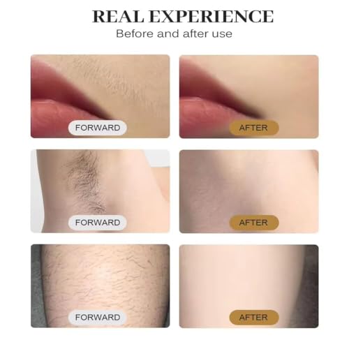 Portable Home Hair Removal Device, Compact Body for Full Body Care, Painless and Long Lasting Hair Regrowth Prevention Tool - Medaid International