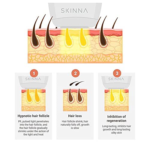 Skinna IPL Laser Hair Removal System | Laser Hair Remover, Permanent Hair Removal for Women & Men | Hair Laser Removal at Home for Face, Arms, Legs, Body, Bikini Line | Painless Hair Removal Laser - Medaid International