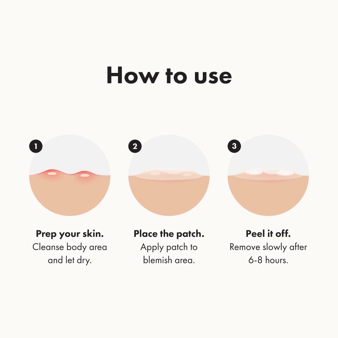 Mighty Patch Hero Cosmetics Body Patch– The XXL Hydrocolloid Patch for Bacne, Chestne, and Other Body Breakouts. Derm-Tested. Medical-Grade Hydrocolloid. Absorbs Pimple Gunk in 6-8 Hours. 4ct - Medaid International