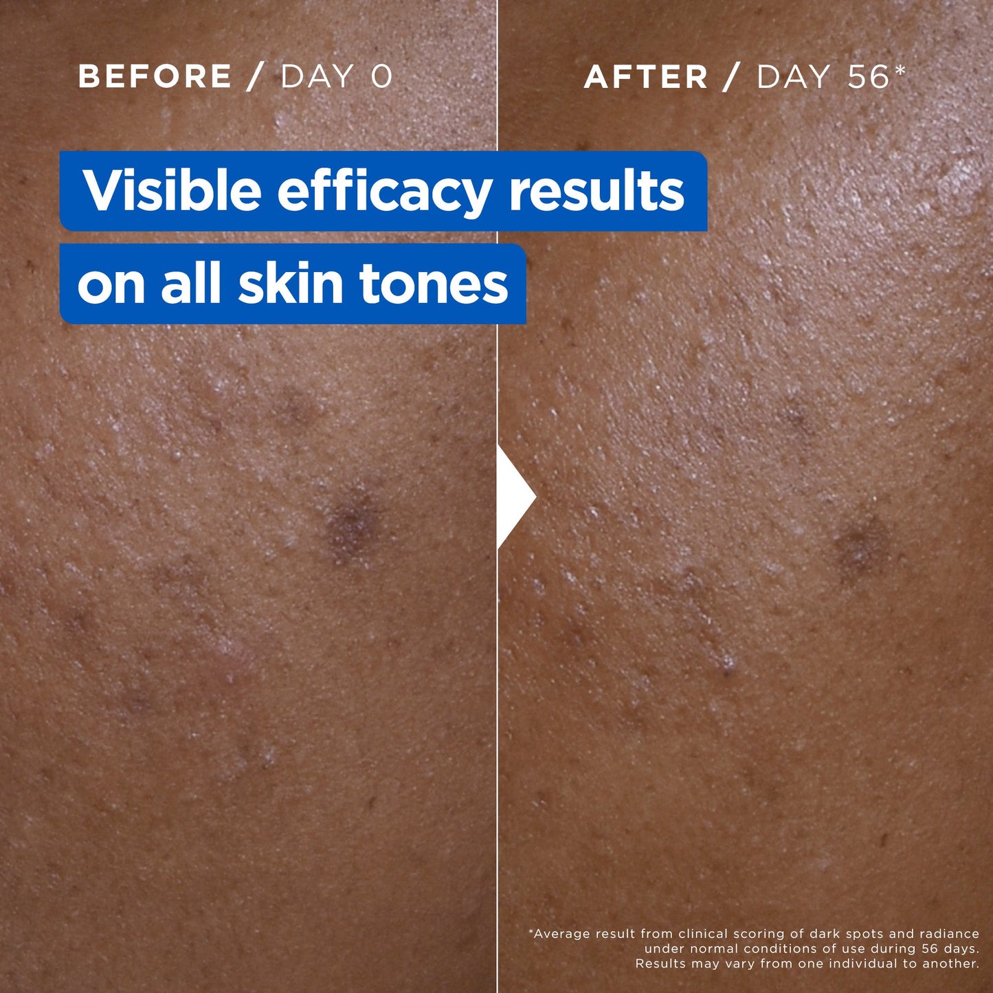 Mixa Niacinamide Bright Moisturising Anti-Dark Spot Cream Jar