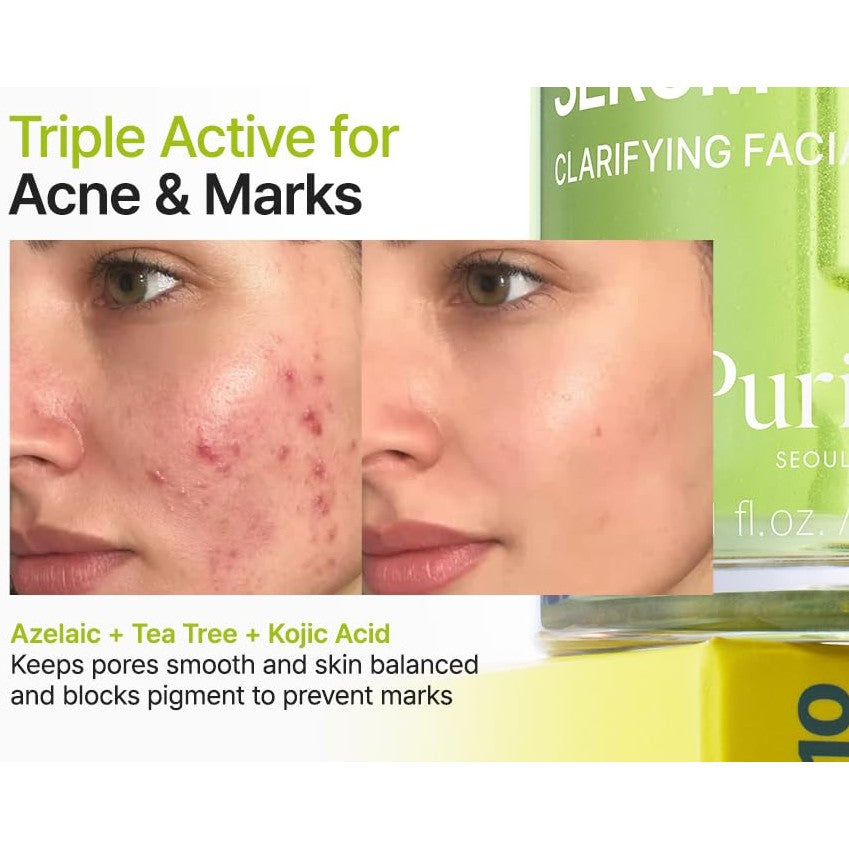 PURITO Azelaic Acid 10% + Kojic Acid + Tea Tree Facial Serum | for Acne & Marks, Breakouts | High-Level Azelaic Acid 10% | Korean skincare, 30mL 1.01 fl.oz - Medaid International