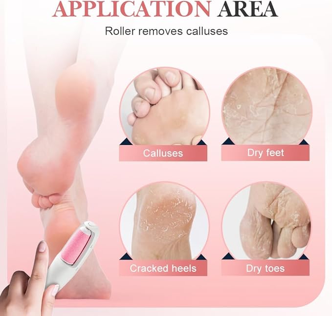 2-in-1 Electric Foot File – Dead Skin & Callus Remover