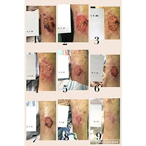 Natura Resort AMAZON Arkada TC16 Serum - Medaid International
