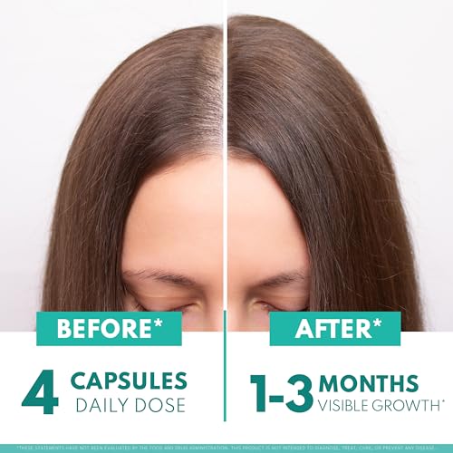 Women's Balance Hair Growth Supplements, Ages 45 and Up, Customer Proven for Visibly Thicker Hair and Scalp Coverage, Soy-Free, Made with 26 Ingredients Including Beta Carotenes - 2 Month Supply - Medaid International