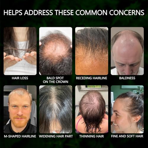 Minoxidil for Men and Women Hair Growth Spray, 5% Minoxidil Beard Growth Oil, Advanced Hair Regrowth Serum Topical Solution Spray Treatment for Hair Loss, Thinning, Hair Regrowth & Thicker 2.02 fl.oz - Medaid International