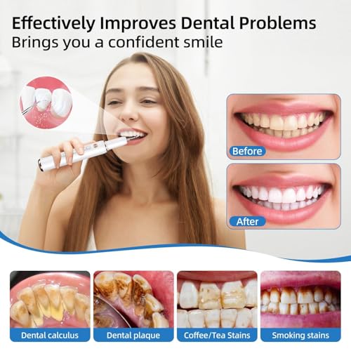 Ausha - Ultrasonic Electric Teeth Cleaner, 5 Modes, Rechargeable Plaque Remover