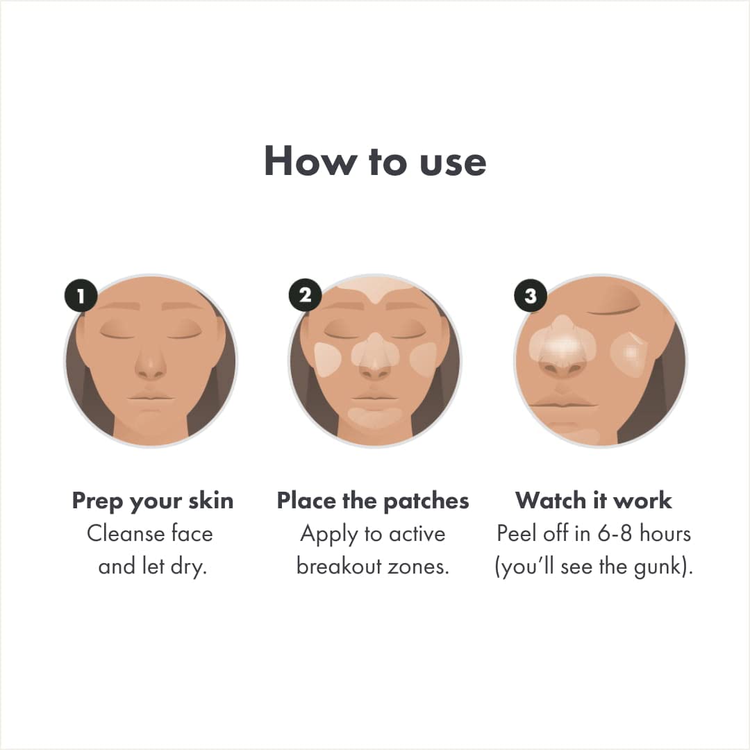 Hero Cosmetics Mighty Patch™ Face Patch - XL Hydrocolloid Face Mask for Acne, 5 Large Pimple Patches for Zit Breakouts on Nose, Chin, Forehead & Cheeks (1 Count) - Medaid International