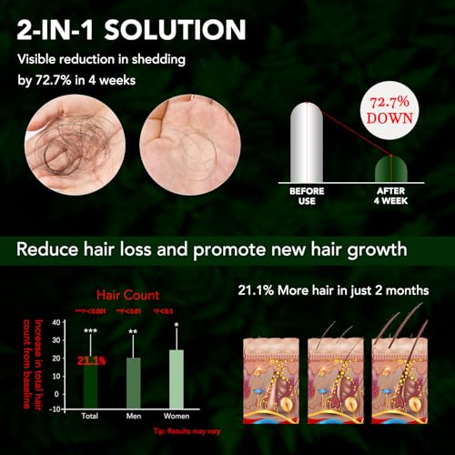 Minoxidil for Men and Women Hair Growth Spray, 5% Minoxidil Beard Growth Oil, Advanced Hair Regrowth Serum Topical Solution Spray Treatment for Hair Loss, Thinning, Hair Regrowth & Thicker 2.02 fl.oz - Medaid International