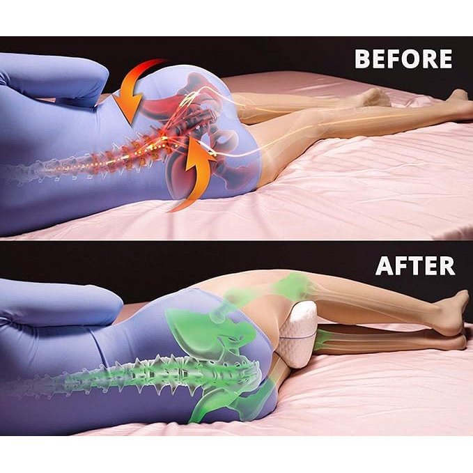 Pressure Reliever Leg Pillow
