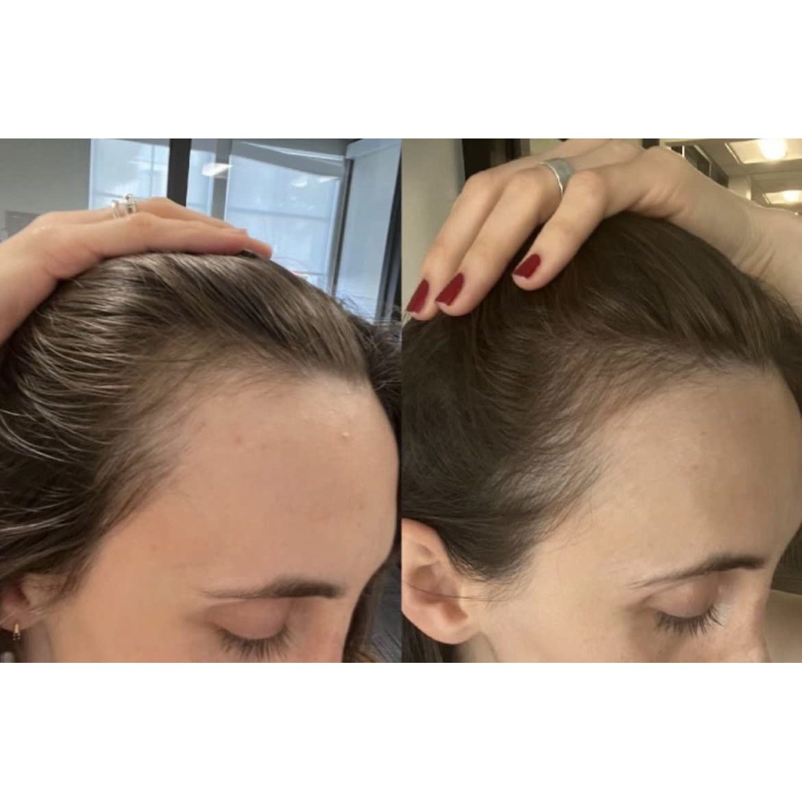 bur bur - Growing Season Hair Growth And Repair Oil | 50 mL - Medaid International