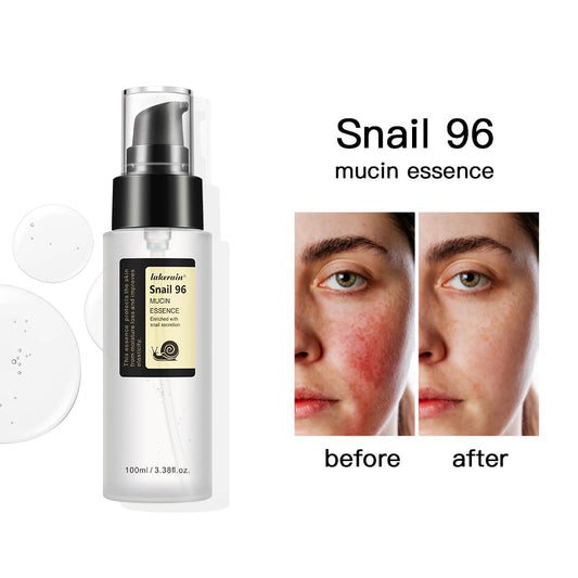 Advanced Snail 96 Mucin Power Essence | سيروم الحلزون