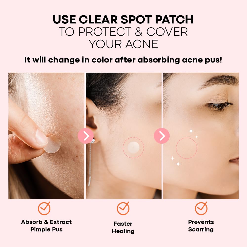 NOLAHOUR Pimple Clear Spot Patch 26 Patches (Daytime Protects & Covers Zits, Transparent) - Medaid International